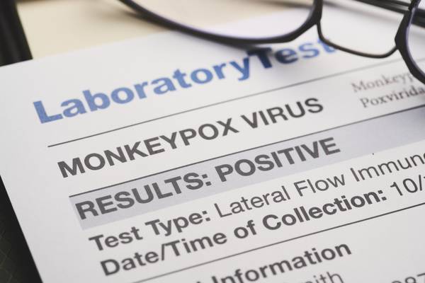 Monkeypox: Kentucky, North Carolina confirm first cases of virus; US cases now total 199